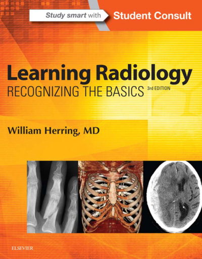 Learning Radiology: Recognizing The Basics / William Herring